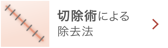 切除術による除去法