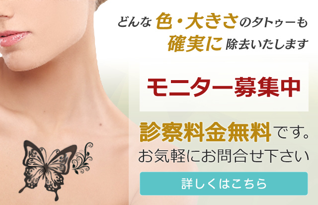 確実なタトゥー除去をご提案